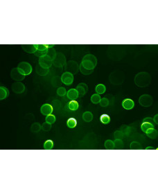 Carboxyfluorescein succinimidyl ester (CFSE)